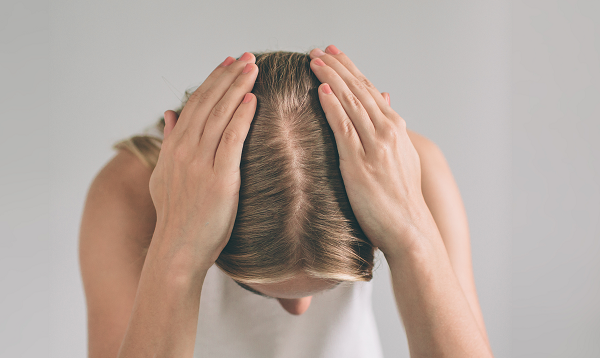Šta izaziva i kako sprečiti opadanje kose?